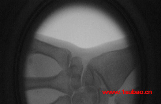 维安泰100毫安便携式X光机   高清楚 价优惠 便携式X射线安检仪 便携式X射线仪图5