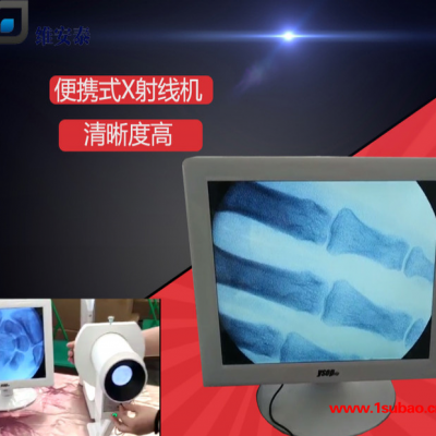 维安泰便携式X射线仪器骨科四肢透视诊疗便携式X光机厂家直供