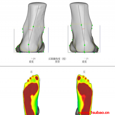 脚底3D扫描仪哪家好-脚底3D扫描仪-北京中科汇成